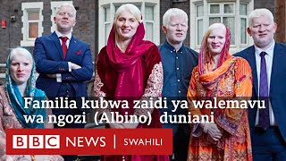 Familia kubwa zaidi ya walemavu wa ngozi (Albino)  duniani - Guiness Records