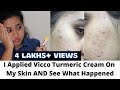 ❌🔴 I Applied Vicco Turmeric On My Skin & See What Happened | Side Effects Of Vicco Turmeric Cream