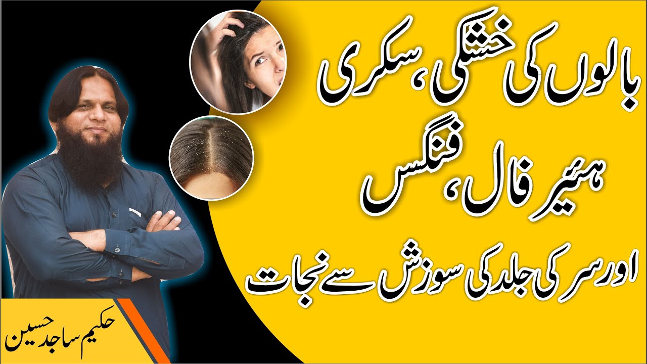 sar ki khushki ka ilaj Hair Dandruff Treatment At home Dandruff hair Fall aur Hair Fungus