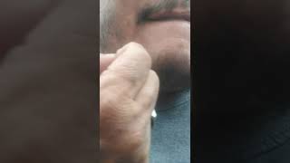 Cara Cabut Uban Di Jenggotshorts