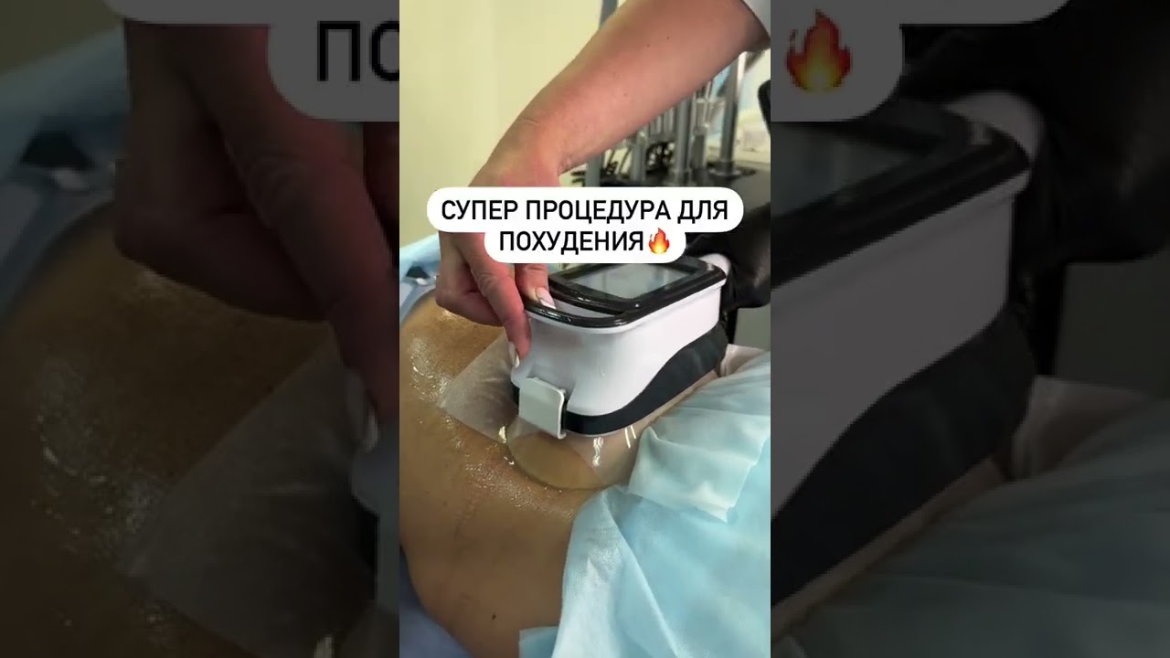 Супер процедура для похудения