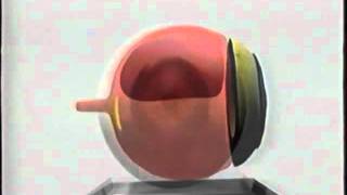 Why face down following vitrectomy surgery 