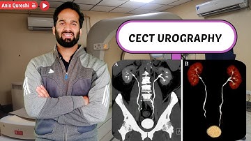 CECT Urography with Fliming | By Anis Qureshi