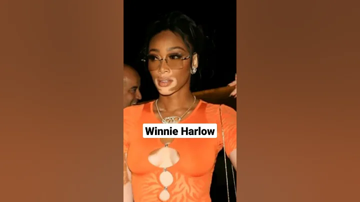 Winnie Harlow Caught Dating Kuzma!       #winnieha #hollywood #media #art
