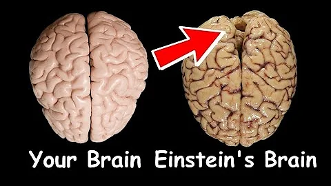 How Albert Einstein's brain was different from a normal human brain? Einstein's brain after death??