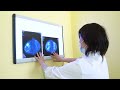 Онкологический центр Томотерапии "YMIT": Интервью с маммологом Бримова Айгуль Демеугалиевна