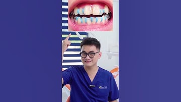 Đặt chun tách kẽ niềng răng có đau không | Nha Khoa ViDental #nhasi #shorts #niengrang #trending