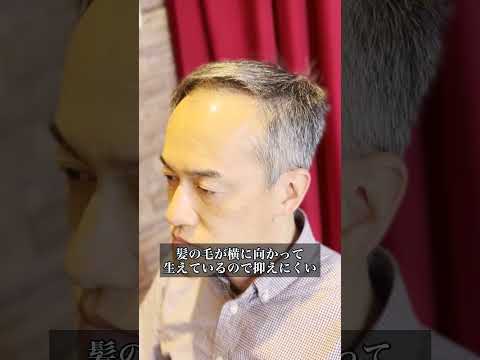広くなったおでこ、隠すのはもう限界!?M字ハゲ対策に知っておきたい髪型! #M字ハゲ #薄毛男性 #新宿