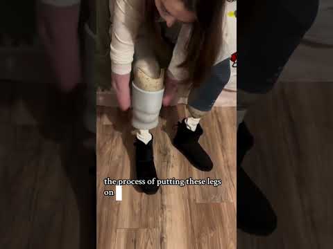 How Amputees Get Ready to Fit a Prosthetic Limb #shorts #amputees #shortsfeed