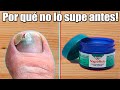 10 USOS QUE NO SABIAS¡ DEL VICK VAPORUB Devora los hongos EN TIEMPO RÉCORD