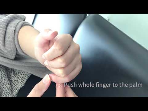 PHYSIOTHERAPY EXERCISE RECOMMENDATIONS FOR MALLET FINGER INJURY - YouTube
