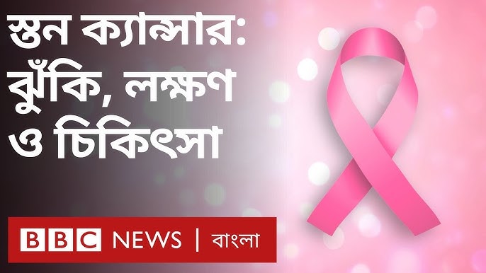 স্তন ক্যান্সার: প্রতিরোধ ও সচেতনতার গুরুত্বপূর্ণ দিক