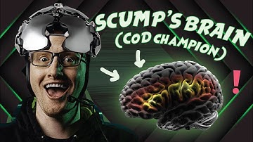 CoD Champ vs Millionaire. Whose brain is better? [Teaser]