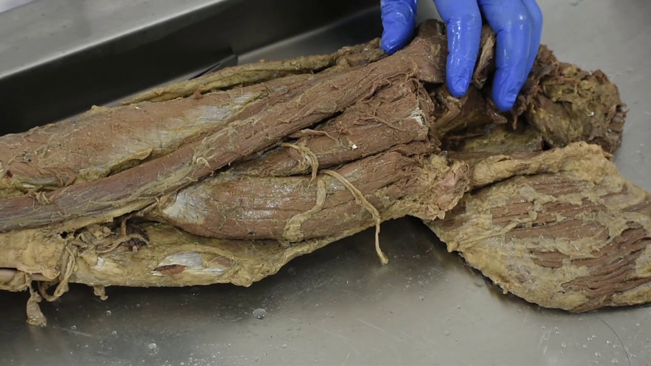 Dissection Fast Revision of Lower Limb Part 1 YouTube