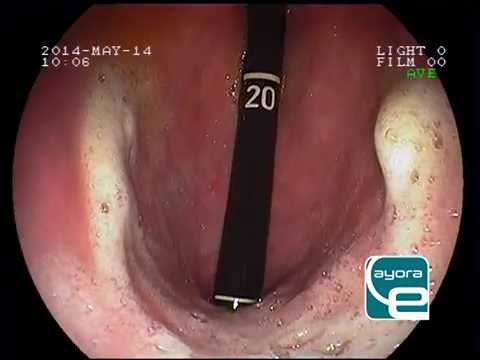 como se diagnostica la gastritis en perros