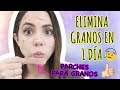 CÓMO QUITAR GRANOS EN 1 DÍA | What The Chic