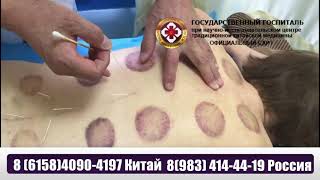 Процедура иглоукалывания в госпитале ТКМ в Китае Далянь Процедура иглоукалывания в госпитале ТКМ в Китае Далянь