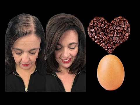 Video: Přírodní ingredience k léčbě vypadávání vlasů