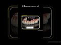 RR Dental lab best dental lab in India