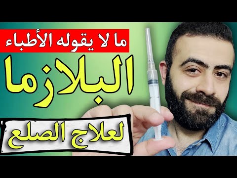 ما لا يقوله الاطباء عن البلازما لعلاج الصلع الوراثي و انبات الشعر خبايا تقال لاول مره 