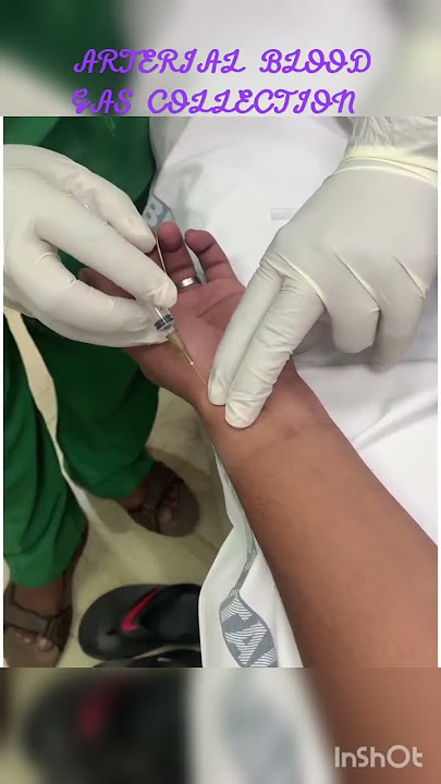 ARTERIAL BLOOD GAS COLLECTION 💉💉