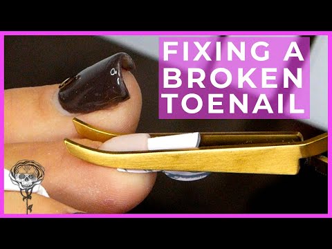 Fixing Fay&rsquo;s Gammy Toe with the Tiniest Ever Sculpting Form!