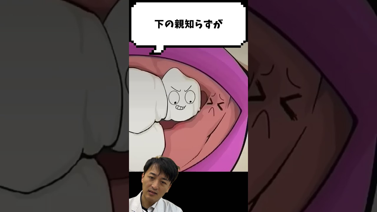 🦷親知らず🦷 #金歯先生 #歯医者 #dentist #歯科医師 #shorts #歯科矯正 #マウスピース矯正 #口臭 #ホワイトニング #歯石 #虫歯
