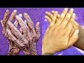 HOW I REMOVE WRINKLES ON MY HANDS & FINGER | CLEAR HAND ROUGHNESS AND DRYNESS