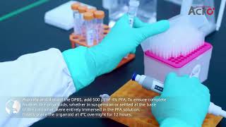 Organoid Fixation