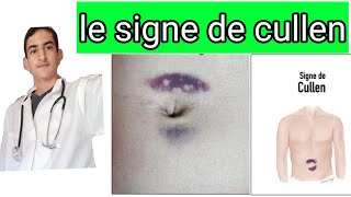 le signe de cullen