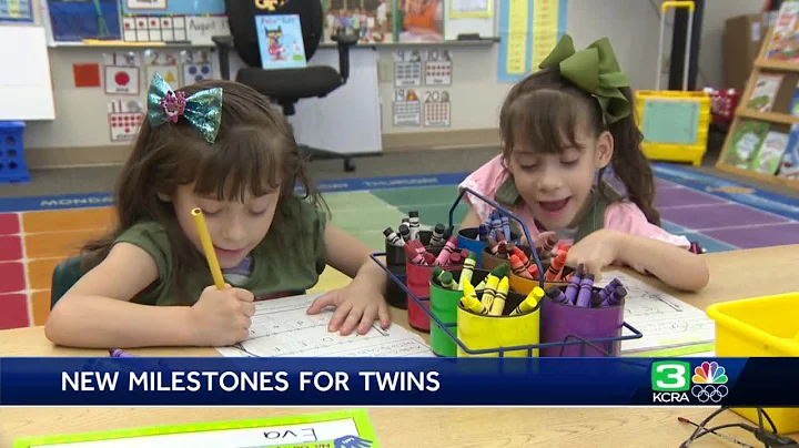 Formerly conjoined twins celebrate 5th birthday, s...