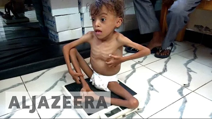 UN: Yemen faces world's 'largest humanitarian crisis'