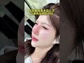 Removal of stitches seven days after rhinoplasty surgery#整形#变美#Rhinoplasty#Rhinoplasty