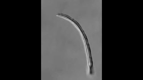 Unfurling a Protein-based Fiddlehead