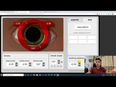 Video HƯỚNG DẪN SOI BÓNG ĐỒNG TỬ GIẢ LẬP - RETINOSCOPY... - youtube