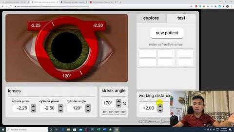 HƯỚNG DẪN SOI BÓNG ĐỒNG TỬ GIẢ LẬP - RETINOSCOPY SIMULATOR - Khúc xạ nhãn khoa Việt Nam
