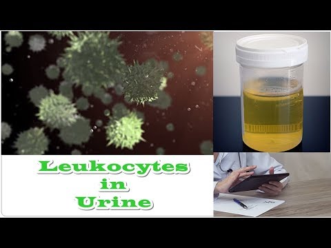 Video: Leukocytes sa ihi