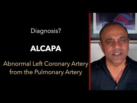 Case #29 | ECG Breakdown