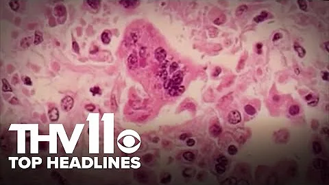 Arkansas's top news stories | April 13, 2025