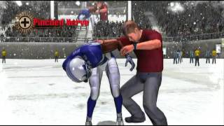 (Re-upload) Blitz The League II Highlights Part 3  - And Then You Stepped On It