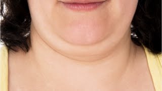 How to Get Rid of Double Chin Fast - Double Chin Exercises