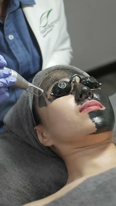 Carbon Blackdoll Laser, Diitemin Tapi Bisa Remajakan Kulit!