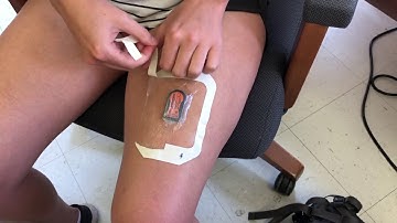 Putting on an ActivPAL 3 Activity Monitor