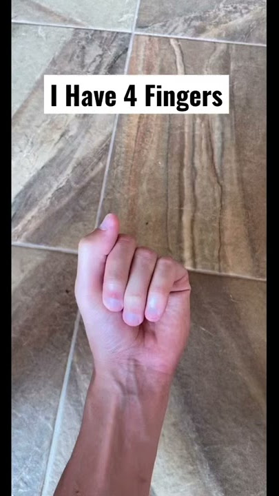 I Have 4 Fingers #Shorts