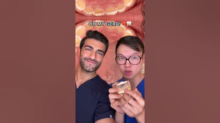 OH MY GERD: Stomach acid in your mouth?! #GERD #acidreflux