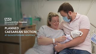 Having a Planned Elective Caesarean Section at Gloucestershire Hospitals