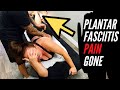 DEEP TISSUE ON PLANTAR FASCIITIS - YEARS OF PAIN GONE (WITH ANATOMY)