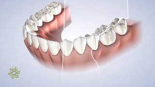 3D CBCT Scanning at Beacon Oral & Maxillofacial Surgeons, Gresham, OR
