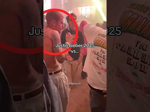 What Happened To Justin Bieber Justinbieber Shorts Youtubeshorts Trending Viral