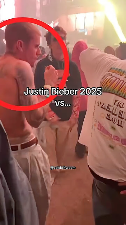 What Happened to Justin Bieber? 😔💔 #justinbieber #shorts #youtubeshorts #trending #viral